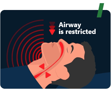 Airway is restricted making snoring sounds
