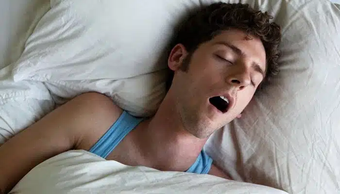 Sleeping with open mouth